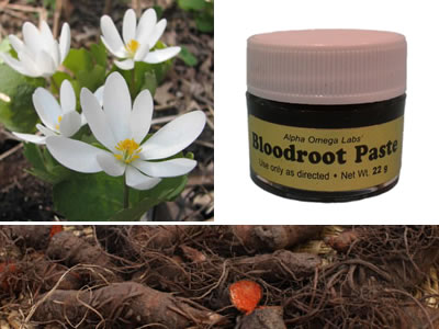 bloodroot