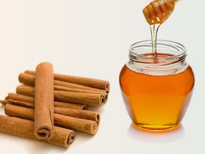 Honey and cinnamon for acne